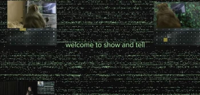 Neuralink brain implant study site